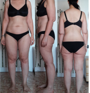 Front, side and back view of women in black bra and underwear after 22 months on keto diet