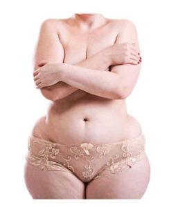 Woman with lipolymphedema wearing panties and covering breasts with arms
