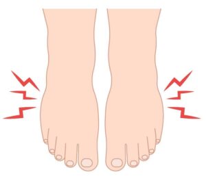 Drawing of feet with red lines demonstrating inflammation