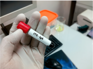 A hand with a test tube labelled tTg-IgA